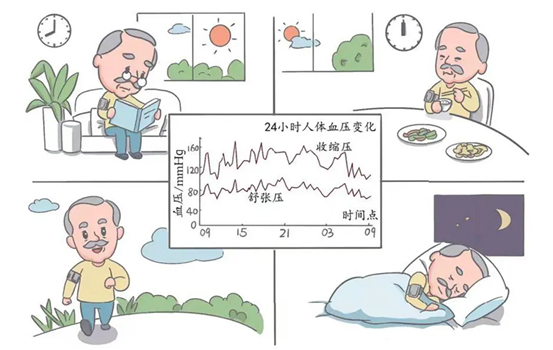動(dòng)態(tài)血壓2