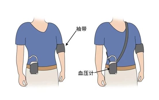動(dòng)態(tài)血壓1